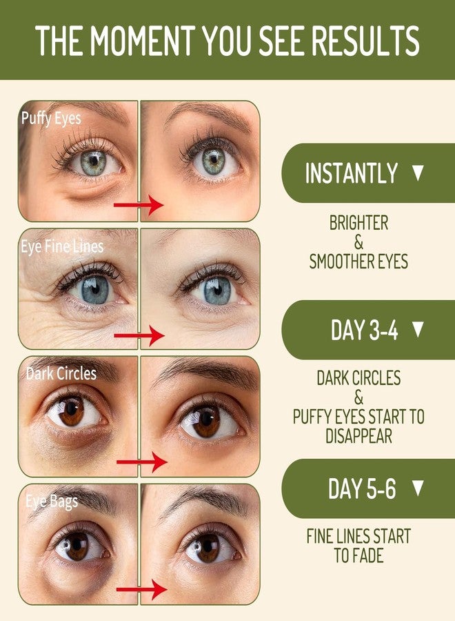 AOAO Roller Ball Eye Serum with Rice Ceramide & Shea Butter for Puffy Bags Fine Lines Dark Circles Wrinkles, Firming & Hydration, Under Eye Cream with 360° Roller Massage Ball, 15ml/0.5fl.oz(2pack) - Image 3